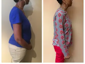 Side-by-side photos showing a person's physical transformation over time.