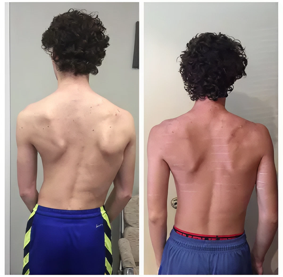 Back transformation comparison